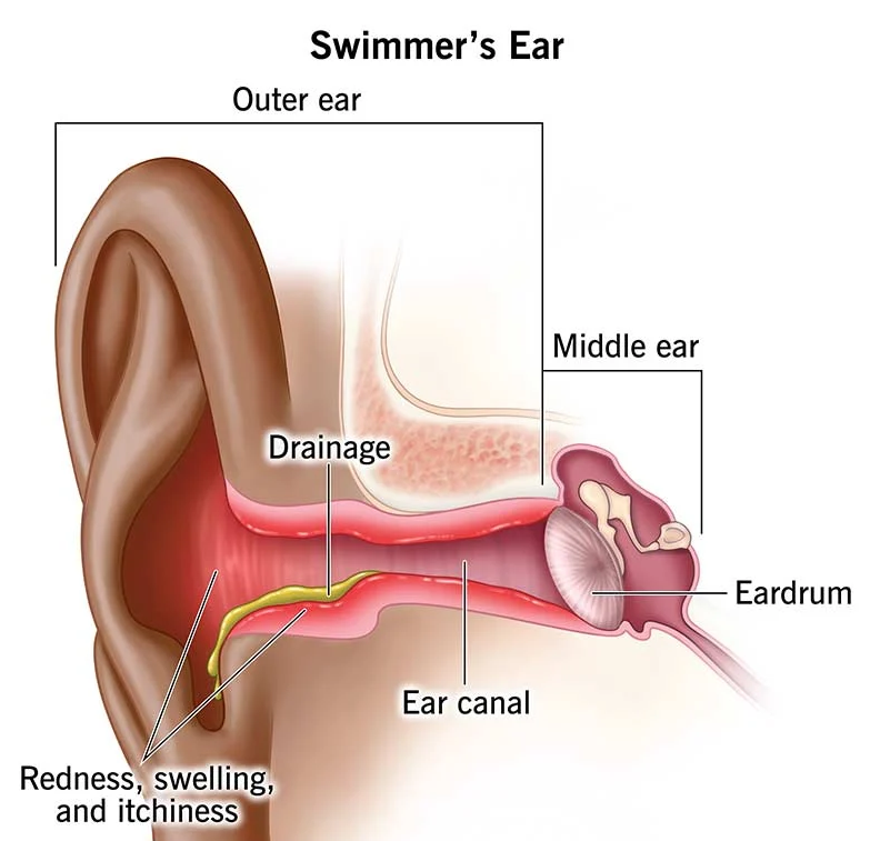 how does water get stuck in your ear